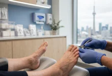 足病 chiropodist 全解：脚痛灰指甲、保险报多少-加拿大大